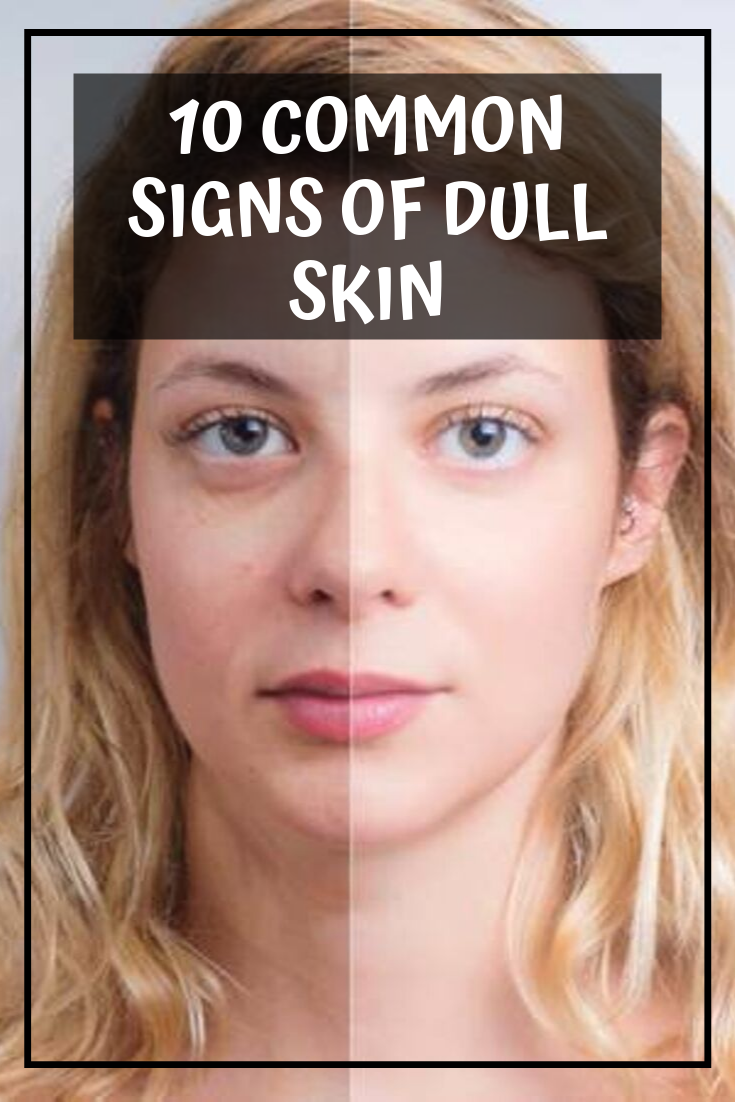 10 Common Signs of DullSkin Complete Makeover